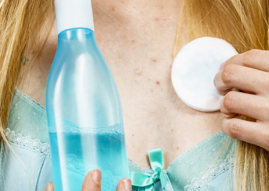 transpiration decollete l'acne